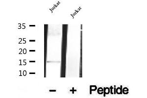 Western blot analysis of extracts of Jurkat cells, using SH2D1B antibody. (SH2D1B antibody  (Internal Region))