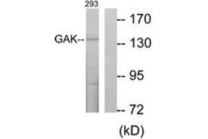 Western blot analysis of extracts from 293 cells, using GAK Antibody. (GAK antibody  (AA 101-150))
