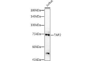 Western blot analysis of extracts of Jurkat cells, using T antibody (ABIN3022236, ABIN3022237, ABIN3022238, ABIN1513586 and ABIN6218687) at 1:1000 dilution.