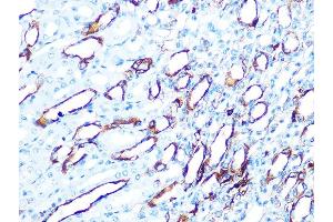 Immunohistochemistry of paraffin-embedded mouse kidney using Cytokeratin 7 (KRT7) (KRT7) Rabbit mAb  at dilution of 1:100 (40x lens).