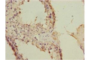 Immunohistochemistry of paraffin-embedded human testis tissue using ABIN7152675 at dilution of 1:100 (FLVCR2 antibody  (AA 1-100))