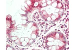 anti-Vesicle Transport through Interaction with T-SNAREs Homolog 1B (VTI1B) (AA 146-195) antibody