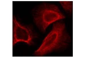 Image no. 2 for anti-Ribosomal Protein S6 Kinase, 70kDa, Polypeptide 1 (RPS6KB1) (pSer424) antibody (ABIN197052) (RPS6KB1 antibody  (pSer424))