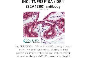 Image no. 1 for anti-Tumor Necrosis Factor Receptor Superfamily, Member 10a (TNFRSF10A) antibody (ABIN5693732) (TNFRSF10A antibody)