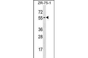 TCN1 Antibody (C-term) (ABIN1537288 and ABIN2838197) western blot analysis in ZR-75-1 cell line lysates (35 μg/lane). (TCN1 antibody  (C-Term))