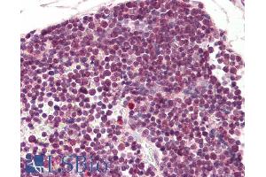 ABIN185256 (3. (RAN antibody  (N-Term))