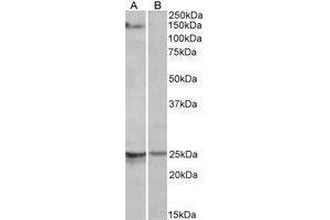 AP22405PU-N RBM20 antibody staining of Mouse Heart lysate at 1 µg/ml (35µg protein in RIPA buffer) with (B) and without (A) blocking with the immunising peptide.