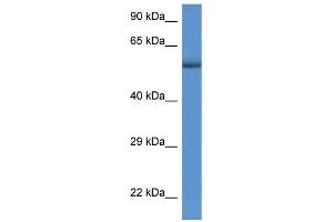 WB Suggested Anti-GBA  Antibody Titration: 1 µg/mL  Positive Control: MDA-MB-435S cell lysate  GBA is strongly supported by BioGPS gene expression data to be expressed in Human MDA-MB435 cells (GBA antibody  (C-Term))