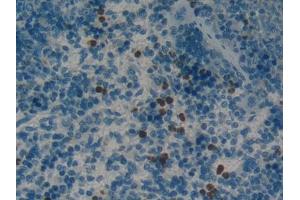 Immunohistochemistry (IHC) image for anti-Fatty Acid Binding Protein 2, Intestinal (FABP2) (AA 2-132) antibody (ABIN1078015)