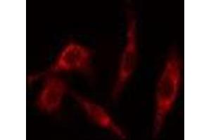 ABIN6277658 staining HeLa cells by IF/ICC. (TK1 antibody  (N-Term))
