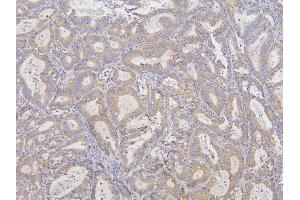 IHC analysis of RNF123 using anti-RNF123 antibody (ABIN6719387). (RNF123 antibody  (AA 12-188))