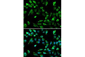 Immunofluorescence analysis of A549 cell using SATB1 antibody. (SATB1 antibody)