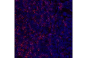 Immunofluorescence (IF) image for anti-CD8a Molecule (CD8A) (C-Term), (Cytoplasmic Domain) antibody (ABIN7449043) (CD8 alpha antibody  (C-Term, Cytoplasmic Domain))
