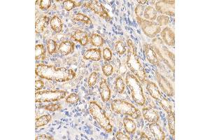 Immunohistochemistry of paraffin-embedded rat kidney using c-Abl Rabbit pAb (ABIN3020871, ABIN3020872, ABIN3020873 and ABIN6213767) at dilution of 1:25 (40x lens).