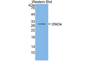 Detection of Recombinant NR0B1, Mouse using Polyclonal Antibody to Nuclear Receptor Subfamily 0, Group B, Member 1 (NR0B1) (NR0B1 antibody  (AA 1-227))