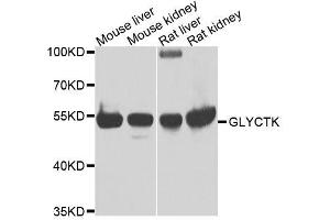 Western blot analysis of extracts of various cell lines, using GLYCTK antibody. (GLYCTK antibody  (AA 284-523))