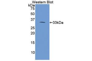 Western blot analysis of the recombinant protein. (PLA2R1 antibody  (AA 385-643))