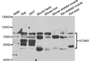 Western blot analysis of extracts of various cell lines, using KCNN3 antibody (ABIN5973609) at 1/1000 dilution.
