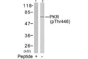 Western blot analysis of extracts from K562 cells using PKR(Phospho-Thr446) Antibody(Lane 2) and the same antibody preincubated with blocking peptide(Lane1). (EIF2AK2 antibody  (pThr446))