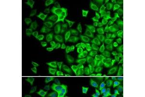 Immunofluorescence analysis of A549 cells using HCK Polyclonal Antibody (HCK antibody)