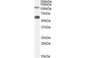 Western Blotting (WB) image for anti-Chromosome 19 Open Reading Frame 66 (C19ORF66) (N-Term) antibody (ABIN2791121)