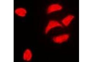 Immunofluorescent analysis of PBOV1 staining in HeLa cells. (PBOV1 antibody)