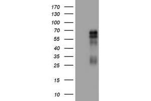 Image no. 1 for anti-Tumor Necrosis Factor Receptor Superfamily, Member 8 (TNFRSF8) (AA 19-379) antibody (ABIN1491091) (TNFRSF8 antibody  (AA 19-379))