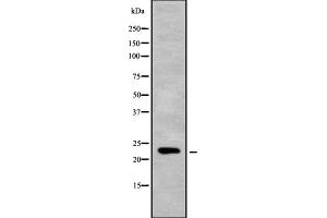Western blot analysis of Mob3C using RAW264. (MOBKL2C antibody  (Internal Region))