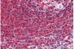 Human Spleen (formalin-fixed, paraffin-embedded) stained with GRB2 antibody ABIN364459 at 5 ug/ml followed by biotinylated anti-mouse IgG secondary antibody ABIN481714, alkaline phosphatase-streptavidin and chromogen. (GRB2 antibody)