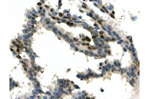 IHC analysis of ITCH/AIP4 using anti-ITCH/AIP4 antibody (ABIN7600264). (ITCH antibody  (AA 17-358))