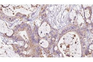 Immunohistochemistry (IHC) image for anti-Cadherin 5 (CDH5) (pTyr731) antibody (ABIN6256011)