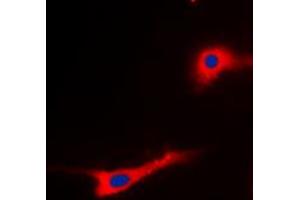 Immunofluorescent analysis of EEF2 (pT56) staining in SKOV3 cells. (EEF2 antibody  (N-Term, pSer56))