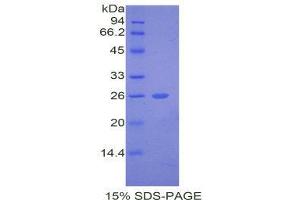 SDS-PAGE (SDS) image for Thyroid Peroxidase (TPO) (AA 19-846) protein (His tag) (ABIN1099513) (Thyroperoxidase Protein (AA 19-846) (His tag))