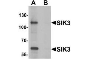 Western blot analysis of SIK3 in rat brain tissue lysate with SIK3 antibody at 1 ug/mL in (A) the absence and (B) the presence of blocking peptide. (SIK3 antibody  (C-Term))