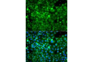 Immunofluorescence analysis of A549 cell using POC1A antibody.