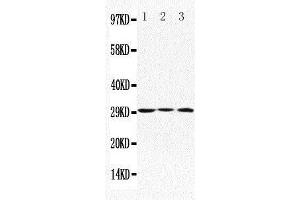 Anti-Apolipoprotein D antibody, Western blotting Lane 1: MCF-7 Cell Lysate Lane 2: HELA Cell Lysate Lane 3: SMMC Cell Lysate