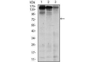 Western blot analysis using MSH6 mouse mAb against MCF-7 (1), HEK293 (2), and HCT116 (3) cell lysate. (MSH6 antibody)