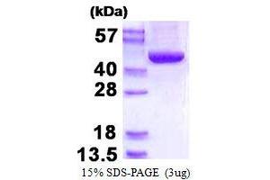 Image no. 1 for Acyl-CoA Dehydrogenase, Short/branched Chain (ACADSB) protein (His tag) (ABIN1098335)