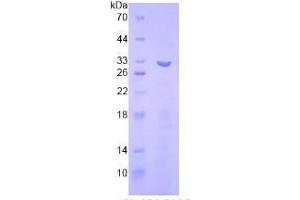 SDS-PAGE analysis of Human ITFG1 Protein. (ITFG1 Protein)