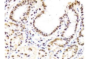 Immunohistochemistry of paraffin-embedded human stomach using PCNA antibody. (PCNA antibody)