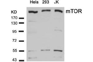 Image no. 1 for anti-Mechanistic Target of Rapamycin (serine/threonine Kinase) (mTOR) (Ser2448) antibody (ABIN319330) (MTOR antibody  (Ser2448))