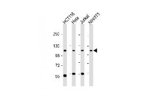 All lanes : Anti-PRPF6 Antibody (N-term) at 1:6000 dilution Lane 1: HC whole cell lysate Lane 2: Hela whole cell lysate Lane 3: Jurka twhole cell lysate Lane 4: NIH/3T3 whole cell lysate Lysates/proteins at 20 μg per lane.