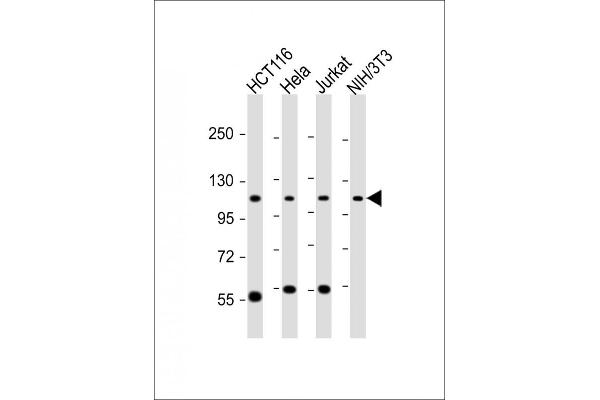 PRP6/ANT-1 抗体  (N-Term)