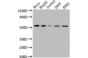 Western Blot Positive WB detected in: Hela whole cell lysate, HepG2 whole cell lysate, Jurkat whole cell lysate, 293T whole cell lysate, K562 whole cell lysate All lanes: MCT1 antibody at 1:1000 Secondary Goat polyclonal to rabbit IgG at 1/50000 dilution Predicted band size: 54, 47 kDa Observed band size: 54 kDa (Recombinant SLC16A1 antibody)
