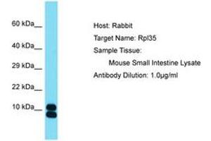 Image no. 1 for anti-Ribosomal Protein L35 (RPL35) (AA 61-110) antibody (ABIN6750520) (RPL35 antibody  (AA 61-110))