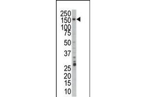 Western blot analysis of anti-PRP4 Pab in Jurkat cell lysate (PRPF4B antibody  (C-Term))
