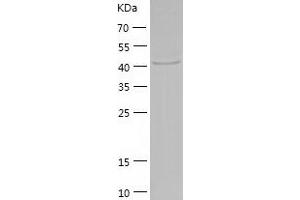 Western Blotting (WB) image for Queuine tRNA-Ribosyltransferase Domain Containing 1 (QTRTD1) (AA 1-415) protein (His tag) (ABIN7288860) (QTRTD1 Protein (AA 1-415) (His tag))