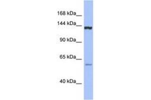 DHX34 antibody  (C-Term)