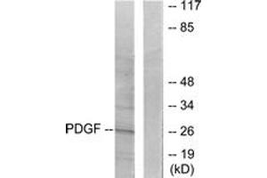 Western blot analysis of extracts from NIH-3T3 cells, using PDGFB Antibody. (PDGFB antibody  (AA 16-65))