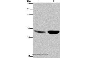 Western blot analysis of Human fetal brain and mouse brain tissue, using MAPRE3 Polyclonal Antibody at dilution of 1:500